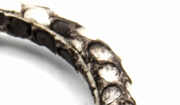 The Status Bracelet